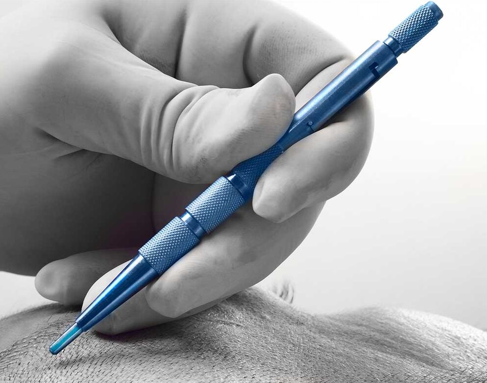 Sapphire FUE Treatment in Turkey Sapphire FUE Treatment in Turkey
